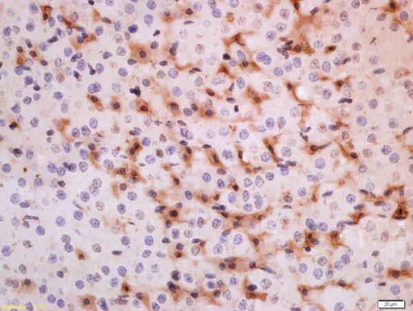 Formalin-fixed and paraffin embedded rat adrenal gland labeled with Anti-ADRB3 Polyclonal Antibody, Unconjugated (bs-10921R) at 1:200 followed by conjugation to the secondary antibody and DAB staining.