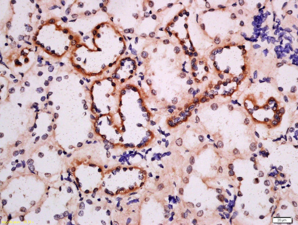 Formalin-fixed and paraffin embedded human kidney labeled with Anti-ADRB3 Polyclonal Antibody, Unconjugated (bs-10921R) at 1:200 followed by conjugation to the secondary antibody and DAB staining.