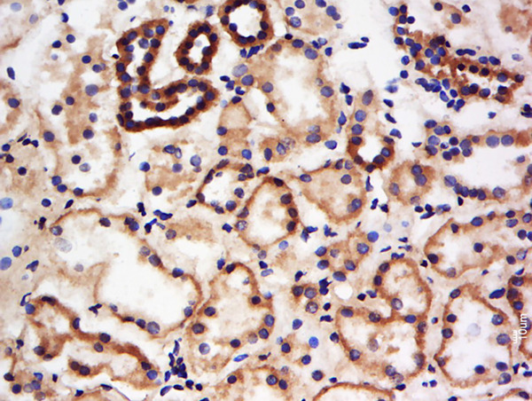 Formalin-fixed and paraffin embedded mouse kidney labeled with Anti-BPNT1 Polyclonal Antibody, Unconjugated (bs-20136R) at 1:200 followed by conjugation to the secondary antibody and DAB staining.