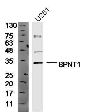 Human U251 cell lysates probed with Anti-BPNT1 Polyclonal Antibody, Unconjugated (bs-20136R) at 1:300 overnight at 4˚C. Followed by a conjugated secondary antibody (bs-0295G-HRP) at 1:10000 for 90 min at 37˚C.
