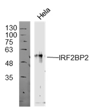 Human HeLa lysate 30ug, probed (bs-16701R) at 1:300 overnight in 4˚C. Followed by conjugation to the secondary antibody (bs-0295G-HRP) at 1:10000 90min in 37˚C.