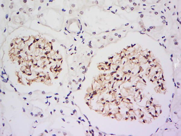 Formalin-fixed and paraffin embedded human kidney labeled with Anti-IRF2BP2 Polyclonal Antibody, Unconjugated (bs-16701R) at 1:200 followed by conjugation to the secondary antibody and DAB staining. Formalin-fixed and paraffin embedded human kidney labeled with Anti-IRF2BP2 Polyclonal Antibody, Unconjugated (bs-16701R) at 1:200 followed by conjugation to the secondary antibody and DAB staining.