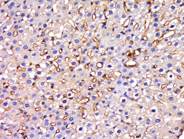 Formalin-fixed and paraffin embedded mouse liver labeled with Anti-HIATL1 Polyclonal Antibody, Unconjugated (bs-16504R) at 1:200 followed by conjugation to the secondary antibody and DAB staining.
