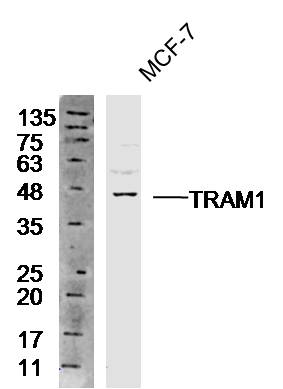 Human MCF7 cell lysates probed with Anti-TRAM1 Polyclonal Antibody, Unconjugated (bs-16565R) at 1:300 overnight at 4˚C. Followed by a conjugated secondary antibody (bs-0295G-HRP) at 1:10000 for 90 min at 37˚C. Human MCF7 cell lysates probed with Anti-TRAM1 Polyclonal Antibody, Unconjugated (bs-16565R) at 1:300 overnight at 4˚C. Followed by a conjugated secondary antibody (bs-0295G-HRP) at 1:10000 for 90 min at 37˚C.