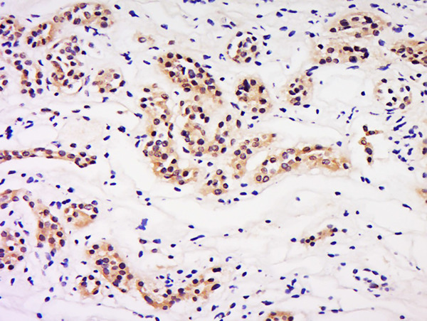 Formalin-fixed and paraffin embedded human kidney labeled with Anti-LIN9 Polyclonal Antibody, Unconjugated (bs-18283R) at 1:200 followed by conjugation to the secondary antibody and DAB staining.\n
