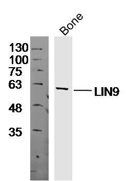 Mouse bone lysates probed with Anti-LIN9 Polyclonal Antibody, Unconjugated (bs-18283R) at 1:300 overnight at 4˚C. Followed by a conjugated secondary antibody (bs-0295G-HRP) at 1:10000 for 90 min at 37˚C.\n