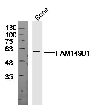 Mouse bone lysates probed with Anti-FAM149B1 Polyclonal Antibody, Unconjugated (bs-14730R) at 1:300 overnight at 4˚C. Followed by a conjugated secondary antibody (bs-0295G-HRP) at 1:10000 for 90 min at 37˚C.