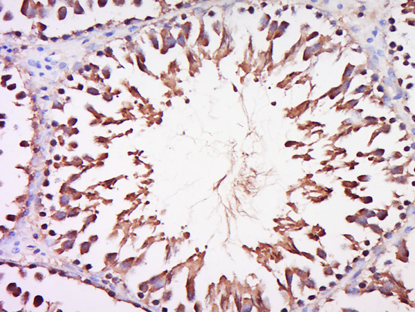 Formalin-fixed and paraffin embedded rat testis labeled with Anti-DARS2 Polyclonal Antibody, Unconjugated (bs-14198R) at 1:200 followed by conjugation to the secondary antibody and DAB staining.
