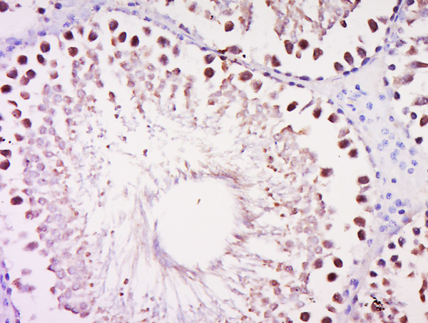 Formalin-fixed and paraffin embedded rat testis labeled with Anti-DALRD3 Polyclonal Antibodyy, Unconjugated (bs-14192R) at 1:500 followed by conjugation to the secondary antibody and DAB staining.