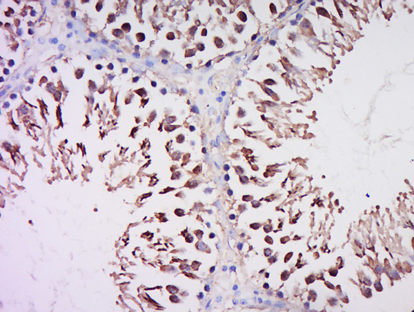 Formalin-fixed and paraffin embedded rat testis labeled with Anti-CEP70 Polyclonal Antibody, Unconjugated (bs-13860R) at 1:500 followed by conjugation to the secondary antibody and DAB staining.