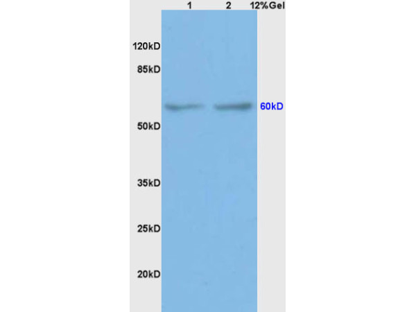 L1 rat brain lysates L2 mouse intestine lysates probed with Anti BMPR1A/CD292 Polyclonal Antibody, Unconjugated (bs-1509R) at 1:200 overnight at 4˚C. Followed by conjugation to secondary antibody (bs-0295G-HRP) at 1:3000 for 90 min at 37˚C. Predicted band 60kD. Observed band size:60kD.\n