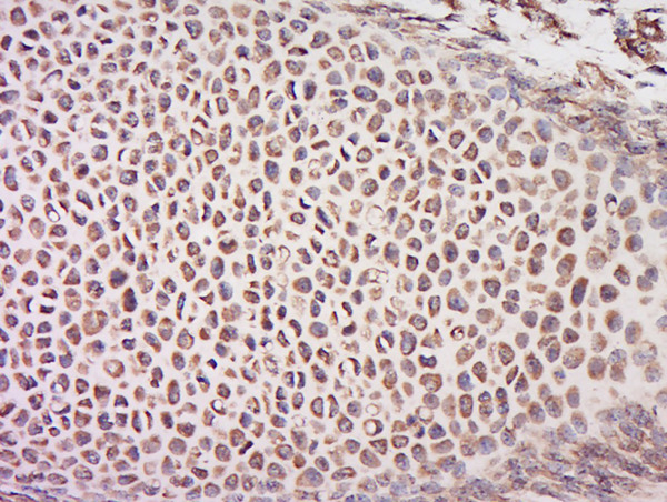 Paraformaldehyde-fixed, paraffin embedded mouse embryo; Antigen retrieval by boiling in sodium citrate buffer (pH6) for 15min; Block endogenous peroxidase by 3% hydrogen peroxide for 30 minutes; Blocking buffer (normal goat serum) at 37°C for 20min; Antibody incubation with ARabbit Anti-CEP70 Polyclonal Antibody, Unconjugated (bs-13860R) at 1:200 overnight at 4°C, followed by a conjugated secondary for 90 minutes and DAB staining.