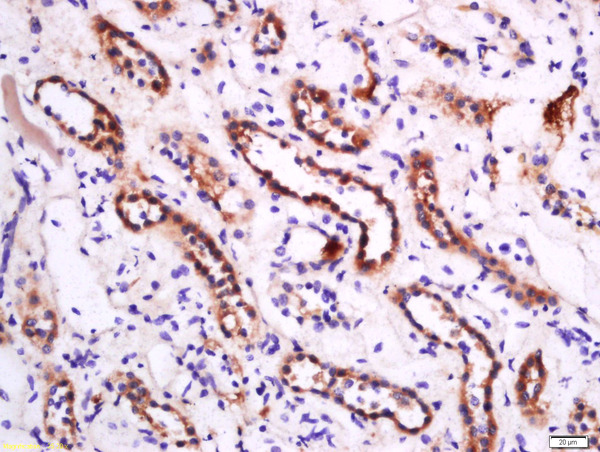 Paraformaldehyde-fixed, paraffin embedded human kidney; Antigen retrieval by boiling in sodium citrate buffer (pH6) for 15min; Block endogenous peroxidase by 3% hydrogen peroxide for 30 minutes; Blocking buffer (normal goat serum) at 37°C for 20min; Antibody incubation with Rabbit Anti-APOA1 Polyclonal Antibody, Unconjugated (bs-0849R) at 1:200 overnight at 4°C, followed by a conjugated secondary for 90 minutes and DAB staining.
