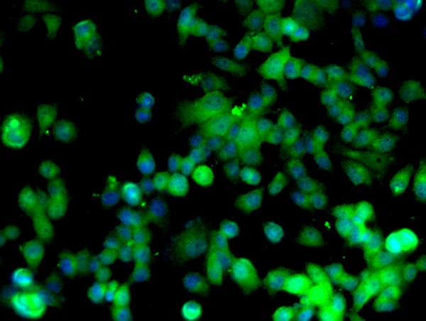 Image provided by One World Lab validation program. MCF-7 cells probed with Rabbit Anti-Cyclin D1 Polyclonal Antibody (bs-0623R) at 1:50 for 60 minutes at room temperature followed by Goat Anti-Rabbit IgG (H+L) Alexa Fluor 488 Conjugated secondary antibody.