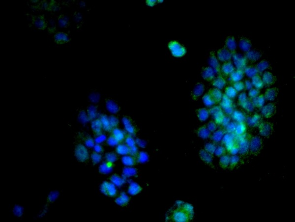 Image provided by One World Lab validation program. A431 cells probed with Rabbit Anti-Cyclin D2 Polyclonal Antibody (bs-1148R) at 1:200 for 60 minutes at room temperature followed by Goat Anti-Rabbit IgG (H+L) Alexa Fluor 488 Conjugated secondary antibody.