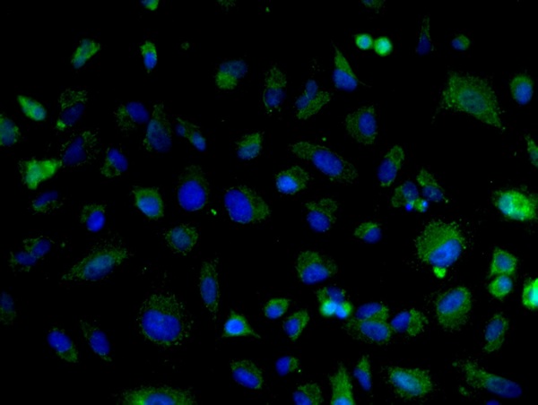 Image provided by One World Lab validation program. A549 cells probed with Rabbit Anti-Cyclin D2 Polyclonal Antibody (bs-1148R) at 1:50 for 60 minutes at room temperature followed by Goat Anti-Rabbit IgG (H+L) Alexa Fluor 488 Conjugated secondary antibody.