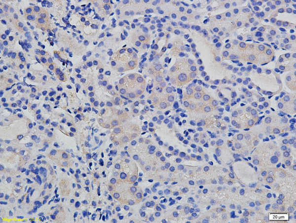 Formalin-fixed and paraffin embedded mouse kidney labeled with  Rabbit Anti E cadherin\/CD324 Polyclonal Antibody, Unconjugated (bs-1519R) at 1:200 followed by conjugation to the secondary antibody and DAB staining
