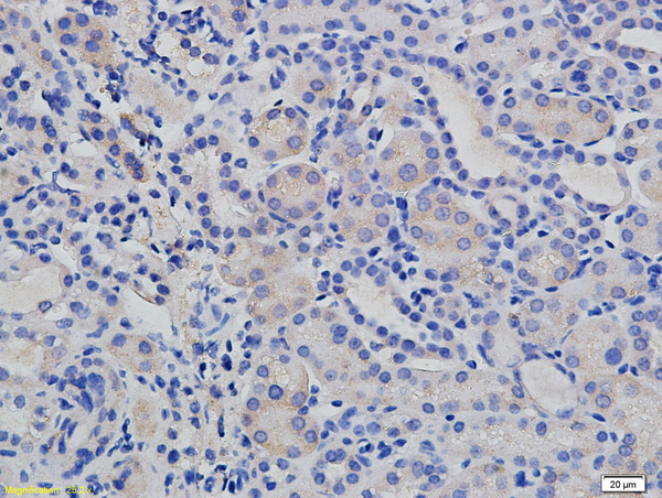 Formalin-fixed and paraffin embedded mouse kidney labeled with Rabbit Anti E cadherin/CD324 Polyclonal Antibody, Unconjugated (bs-1519R) at 1:200 followed by conjugation to the secondary antibody and DAB staining