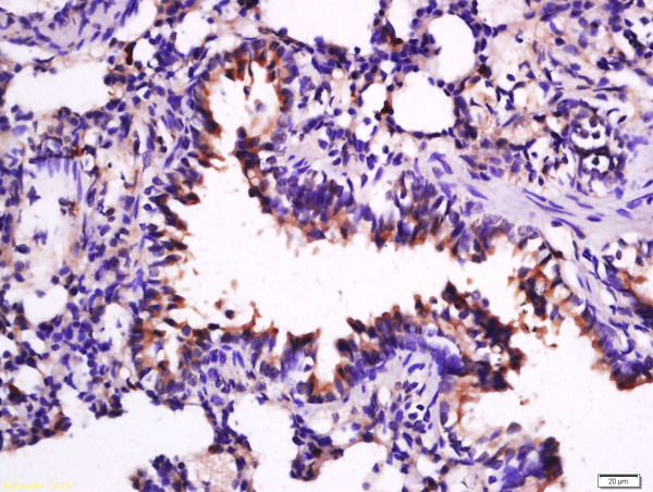 Paraformaldehyde-fixed, paraffin embedded rat lung; Antigen retrieval by boiling in sodium citrate buffer (pH6) for 15min; Block endogenous peroxidase by 3% hydrogen peroxide for 30 minutes; Blocking buffer (normal goat serum) at 37°C for 20min; Antibody incubation with Anti –IL-33 Polyclonal Antibody, Unconjugated (bs-2633R) at 1:200 overnight at 4°C, followed by a conjugated secondary for 90 minutes and DAB staining