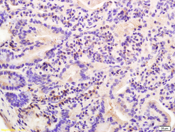 Formalin-fixed and paraffin embedded mouse intestine labeled with  Rabbit Anti E cadherin\/CD324 Polyclonal Antibody, Unconjugated (bs-1519R) at 1:200 followed by conjugation to the secondary antibody and DAB staining