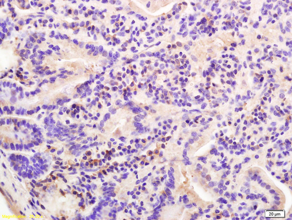 Formalin-fixed and paraffin embedded mouse intestine labeled with Rabbit Anti E cadherin/CD324 Polyclonal Antibody, Unconjugated (bs-1519R) at 1:200 followed by conjugation to the secondary antibody and DAB staining