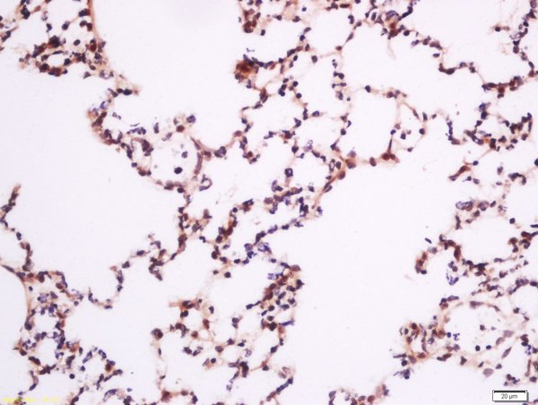 Paraformaldehyde-fixed, paraffin embedded rat lung; Antigen retrieval by boiling in sodium citrate buffer (pH6) for 15min; Block endogenous peroxidase by 3% hydrogen peroxide for 30 minutes; Blocking buffer (normal goat serum) at 37°C for 20min; Antibody incubation with Rabbit Anti-PLC gamma 1 (Tyr783) Polyclonal Antibody, Unconjugated (bs-3343R) at 1:200 overnight at 4°C, followed by a conjugated secondary for 90 minutes and DAB staining