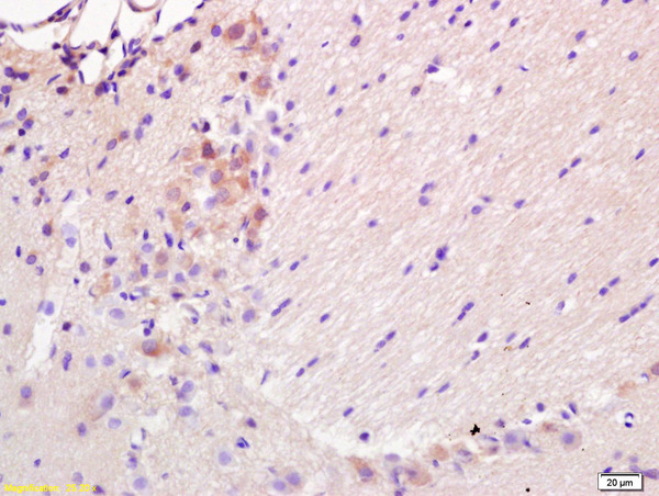 Formalin-fixed and paraffin embedded rat brain labeled with  Rabbit Anti BBC3\/PUMA Polyclonal Antibody, Unconjugated (bs-1573R) at 1:200 followed by conjugation to the secondary antibody and DAB staining