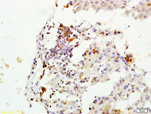Formalin-fixed and paraffin embedded rat liver labeled with Rabbit Anti-MGMT Polyclonal Antibody, Unconjugated (bs-1002R) at 1:200 followed by conjugation to the secondary antibody and DAB staining