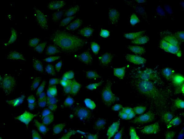 Image provided by One World Lab validation program. MCF-7 cells probed with Rabbit Anti-Integrin Alpha 3 + Beta 1 Polyclonal Antibody (bs-1057R) at 1:50 for 60 minutes at room temperature followed by Goat Anti-Rabbit IgG (H+L) Alexa Fluor 488 Conjugated secondary antibody.