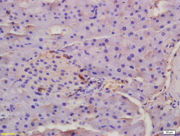 Formalin-fixed and paraffin-embedded Rat Placenta tissue labeled EDA Polyclonal Antibody, Unconjugated (bs-1149R) at 1:200, followed by conjugation to the secondary antibody and DAB staining