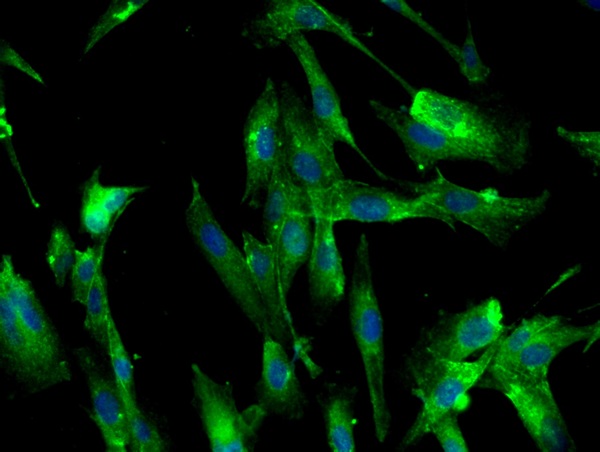 Image provided by One World Lab validation program. U138 cells probed with Rabbit Anti-Transferrin receptor Polyclonal Antibody (bs-0988R) at 1:50 for 60 minutes at room temperature followed by Goat Anti-Rabbit IgG (H+L) Alexa Fluor 488 Conjugated secondary antibody.