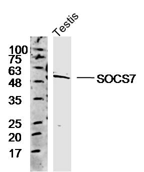Mouse testis lysates probed with Anti-SOCS7 Polyclonal Antibody, Unconjugated (bs-20151R) at 1:500 overnight at 4˚C. Followed by a conjugated secondary antibody (bs-0295G-HRP) at 1:10000 for 90 min at 37˚C. Mouse testis lysates probed with Anti-SOCS7 Polyclonal Antibody, Unconjugated (bs-20151R) at 1:500 overnight at 4˚C. Followed by a conjugated secondary antibody (bs-0295G-HRP) at 1:10000 for 90 min at 37˚C.