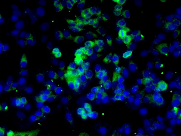 Image provided by One World Lab validation program. MCF-7 cells probed with Rabbit Anti-Caspase 8 Polyclonal Antibody (bs-0052R) at 1:50 for 60 minutes at room temperature followed by Goat Anti-Rabbit IgG (H+L) Alexa Fluor 488 Conjugated secondary antibody.