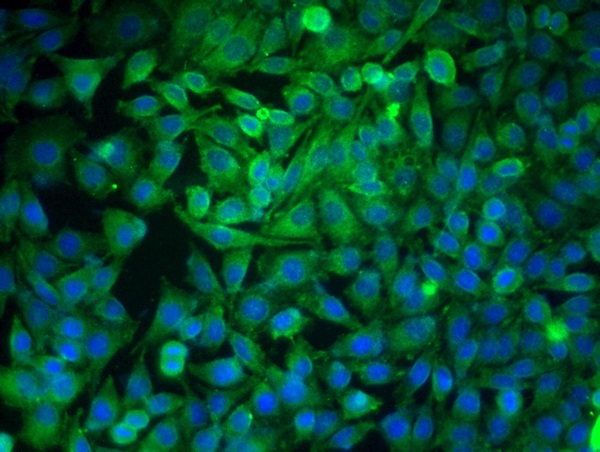 Image provided by One World Lab validation program. SMMC7721 cells probed with Rabbit Anti-GRP78 Polyclonal Antibody (bs-1219R) at 1:100 for 60 minutes at room temperature followed by Goat Anti-Rabbit IgG (H+L) Alexa Fluor 488 Conjugated secondary antibody.