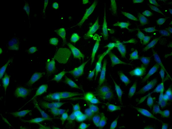 Image provided by One World Lab validation program. PC3 cells probed with Rabbit Anti-GRP78 Polyclonal Antibody (bs-1219R) at 1:100 for 60 minutes at room temperature followed by Goat Anti-Rabbit IgG (H+L) Alexa Fluor 488 Conjugated secondary antibody.