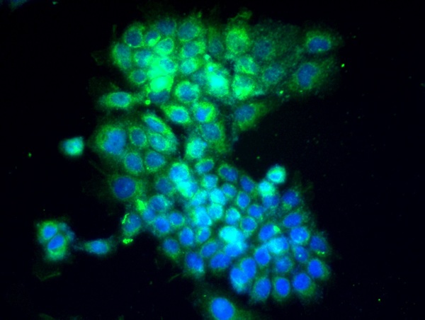 Image provided by One World Lab validation program. A431 cells probed with Rabbit Anti-E cadherin Polyclonal Antibody (bs-10009R) at 1:50 for 60 minutes at room temperature followed by Goat Anti-Rabbit IgG (H+L) Alexa Fluor 488 Conjugated secondary antibody.