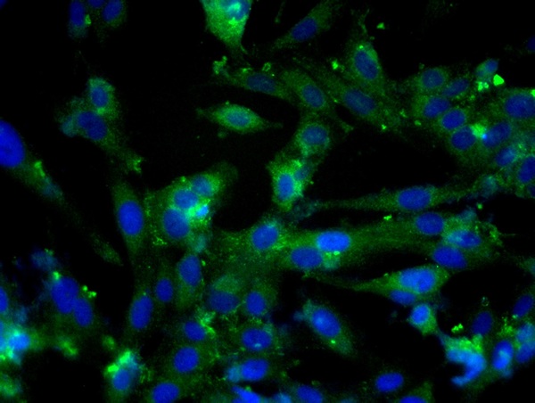 Image provided by One World Lab validation program. U138 cells probed with Rabbit Anti-E cadherin Polyclonal Antibody (bs-10009R) at 1:50 for 60 minutes at room temperature followed by Goat Anti-Rabbit IgG (H+L) Alexa Fluor 488 Conjugated secondary antibody.
