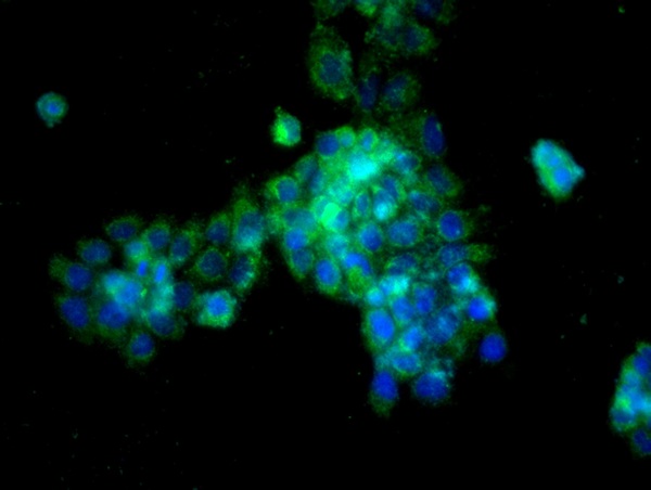 Image provided by One World Lab validation program. A431 cells probed with Rabbit Anti-Cathepsin L Polyclonal Antibody (bs-1508R) at 1:50 for 60 minutes at room temperature followed by Goat Anti-Rabbit IgG (H+L) Alexa Fluor 488 Conjugated secondary antibody.