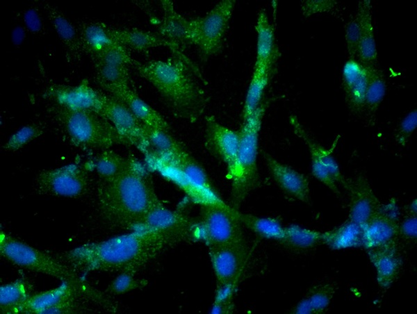 Image provided by One World Lab validation program. U138 cells probed with Rabbit Anti-Cathepsin D/CTSD Polyclonal Antibody (bs-1615R) at 1:50 for 60 minutes at room temperature followed by Goat Anti-Rabbit IgG (H+L) Alexa Fluor 488 Conjugated secondary antibody.