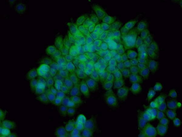 Image provided by One World Lab validation program. A431 cells probed with Rabbit Anti-Bax Polyclonal Antibody (bs-0127R) at 1:100 for 60 minutes at room temperature followed by Goat Anti-Rabbit IgG (H+L) Alexa Fluor 488 Conjugated secondary antibody.