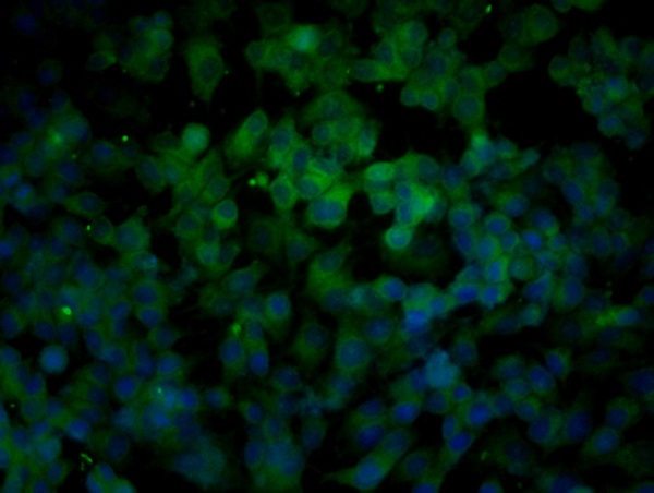 Image provided by One World Lab validation program. MCF-7 cells probed with Rabbit Anti-Bax Polyclonal Antibody (bs-0127R) at 1:100 for 60 minutes at room temperature followed by Goat Anti-Rabbit IgG (H+L) Alexa Fluor 488 Conjugated secondary antibody.