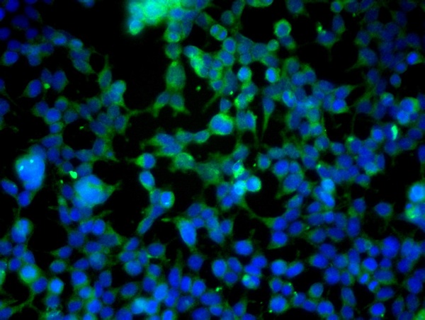 Image provided by One World Lab validation program. HEK293 cells probed with Rabbit Anti-VE Cadherin Polyclonal Antibody (bs-0878R) at 1:100 for 60 minutes at room temperature followed by Goat Anti-Rabbit IgG (H+L) Alexa Fluor 488 Conjugated secondary antibody.