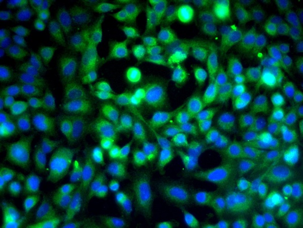 Image provided by One World Lab validation program. A549 cells probed with Rabbit Anti-VE Cadherin Polyclonal Antibody (bs-0878R) at 1:50 for 60 minutes at room temperature followed by Goat Anti-Rabbit IgG (H+L) Alexa Fluor 488 Conjugated secondary antibody.