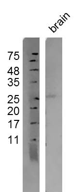 Mouse brain lysates probed with Anti-Persephin Polyclonal Antibody, Unconjugated (bs-1518R) at 1:500 overnight at 4˚C. Followed by a conjugated secondary antibody (bs-0295G-HRP) at 1:10000 for 90 min at 37˚C.\n