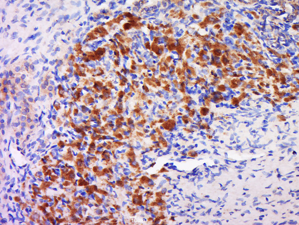 Formalin-fixed and paraffin embedded rat ovary tissue labeled with Anti-GAL3ST4 Polyclonal Antibody, Unconjugated (bs-16215R) at 1:500 followed by conjugation to the secondary antibody and DAB staining