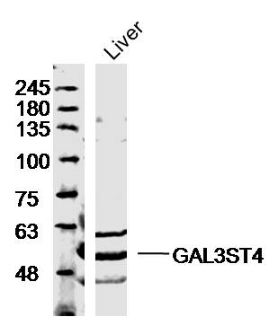 Mouse liver lysates probed with Anti-GAL3ST4 Polyclonal Antibody, Unconjugated (bs-16215R) at 1:500 overnight at 4˚C. Followed by a conjugated secondary antibody (bs-0295G-HRP) at 1:10000 for 90 min at 37˚C. Mouse liver lysates probed with Anti-GAL3ST4 Polyclonal Antibody, Unconjugated (bs-16215R) at 1:500 overnight at 4˚C. Followed by a conjugated secondary antibody (bs-0295G-HRP) at 1:10000 for 90 min at 37˚C.