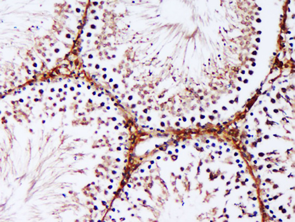 Formalin-fixed and paraffin embedded rat testis labeled with Anti-IRGC Polyclonal Antibody, Unconjugated (bs-16706R) at 1:500 followed by conjugation to the secondary antibody and DAB staining.