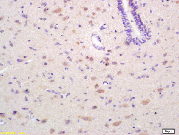 Formalin-fixed and paraffin embedded rat brain labeled with Rabbit Anti EPH receptor A4 Polyclonal Antibody, Unconjugated (bs-1764R) at 1:200 followed by conjugation to the secondary antibody and DAB staining