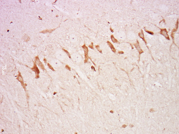 Paraformaldehyde-fixed, paraffin embedded rat brain; Antigen retrieval by boiling in sodium citrate buffer (pH6) for 15min; Block endogenous peroxidase by 3% hydrogen peroxide for 30 minutes; Blocking buffer (normal goat serum) at 37°C for 20min; Antibody incubation with Rabbit Anti-Neurofascin Polyclonal Antibody, Unconjugated (bs-0289R) at 1:500 overnight at 4°C, followed by a conjugated secondary and DAB staining.