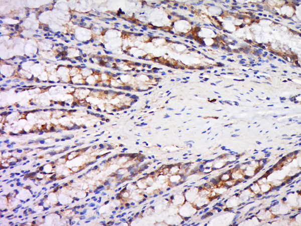 Paraformaldehyde-fixed, paraffin embedded rat rectum; Antigen retrieval by boiling in sodium citrate buffer (pH6) for 15min; Block endogenous peroxidase by 3% hydrogen peroxide for 30 minutes; Blocking buffer (normal goat serum) at 37°C for 20min; Antibody incubation with Rabbit Anti-Maspin Polyclonal Antibody, Unconjugated (bs-0792R) at 1:500 overnight at 4°C, followed by a conjugated secondary and DAB staining.
